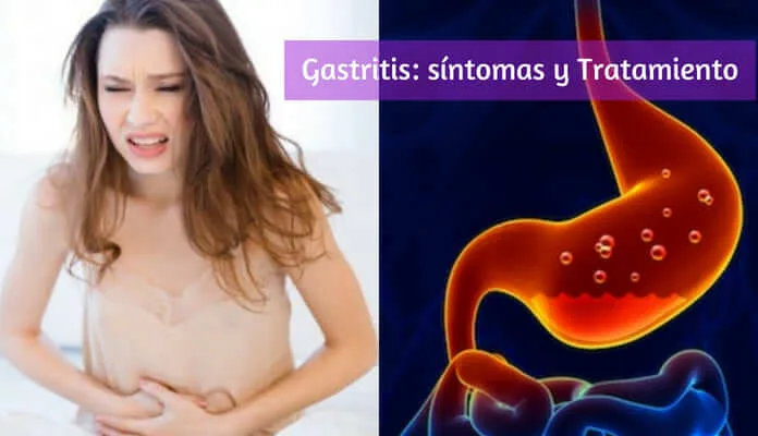 Síntomas de la Gastritis y Remedios Caseros Para Aliviarla [Video]
