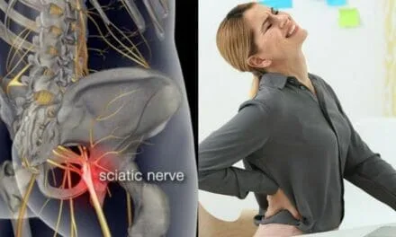Como Curar el Nervio Ciático y el Dolor de Espalda Baja, Cadera y Pierna