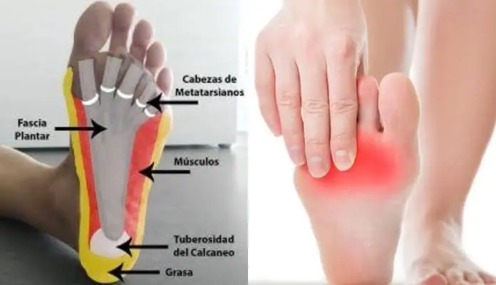 ¿Dolor en la Planta del Pie? Descubre sus Causas